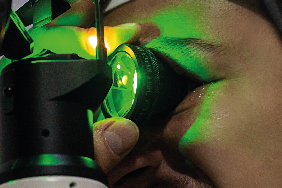 fotocuagulacion de retina laser argon
