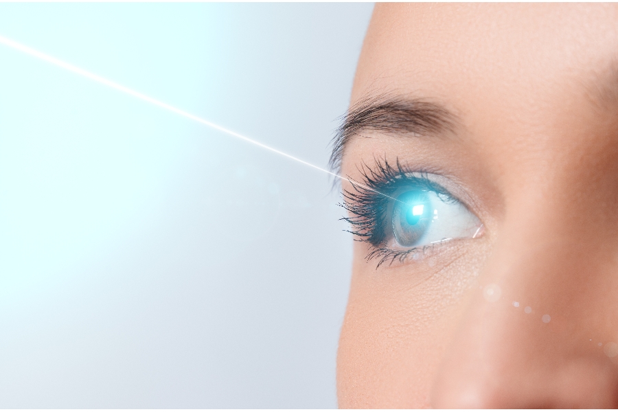 trabeculoplastia laser slt